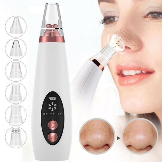 Blackhead Pore Vacuum Cleaner – Gentle and Effective Nose Cleanser